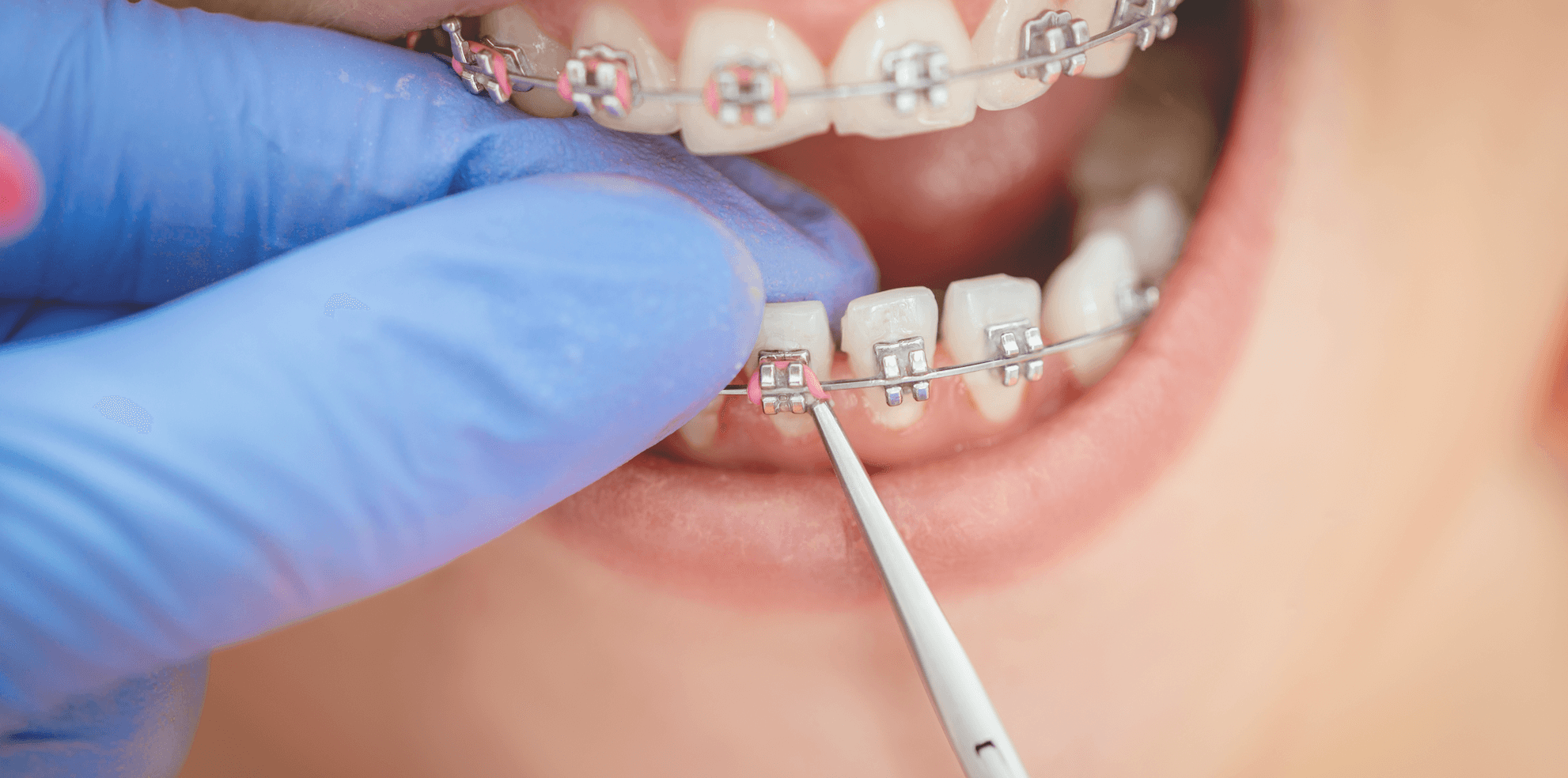 Screenshot 2022-09-16 at 15.37.43